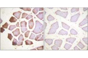 Immunohistochemistry analysis of paraffin-embedded human skeletal muscle tissue, using TNNI3 (Ab-22/23) Antibody. (TNNI3 Antikörper  (AA 5-54))