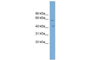 SLC22A10 antibody used at 1 ug/ml to detect target protein. (SLC22A10 Antikörper  (Middle Region))