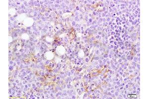 Immunohistochemistry (Paraffin-embedded Sections) (IHC (p)) image for anti-Microtubule Associated Tumor Suppressor 1 (MTUS1) (AA 1151-1270) antibody (ABIN2177806)