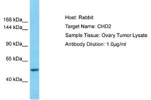 Host: Rabbit Target Name: CHD2 Sample Type: Ovary tumor lysates Antibody Dilution: 1.
