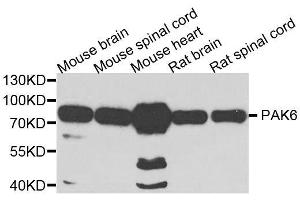 Western blot analysis of extracts of various cell lines, using PAK6 antibody. (PAK6 Antikörper  (AA 1-270))