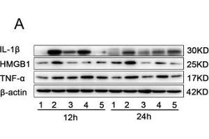The effects of miR-339-5p and paeonol on LPS-induced RAW264. (IL-1 beta Antikörper  (AA 1-269))