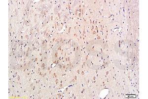 Formalin-fixed and paraffin embedded rat brain labeled with Rabbit Anti-Cytochrome C Polyclonal Antibody, Unconjugated (ABIN723590) 1:300 followed by conjugation to the secondary antibody and DAB staining (Cytochrome C Antikörper  (AA 51-105))