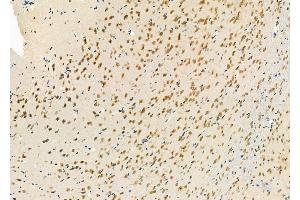 ABIN6264064 and ABIN6277250 at 1/100 staining Rat brain tissue by IHC-P.