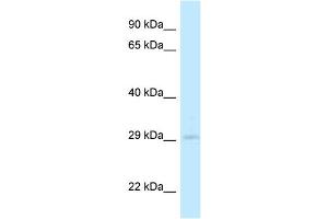 WB Suggested Anti-4933408B17Rik Antibody Titration: 1. (4933408B17Rik Antikörper  (C-Term))