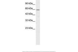 Image no. 1 for anti-Chaperonin Containing TCP1, Subunit 4 (Delta) (CCT4) (AA 453-502) antibody (ABIN6735873) (CCT4 Antikörper  (AA 453-502))
