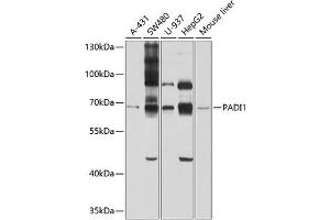 Western blot analysis of extracts of various cell lines, using P antibody (ABIN6128528, ABIN6145161, ABIN6145162 and ABIN6214293) at 1:1000 dilution. (PADI1 Antikörper  (AA 1-260))