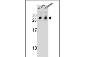 CYB561D1 Antibody (C-term) (ABIN654999 and ABIN2844633) western blot analysis in mouse lung,spleen tissue lysates (35 μg/lane). (CYB561D1 Antikörper  (C-Term))