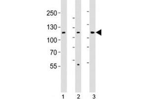 Western blot analysis of lysate from 1) HT-29, 2) HeLa, and 3) Jurkat cell line using JAK1 antibody; Ab was diluted at 1:1000. (JAK1 Antikörper  (N-Term))
