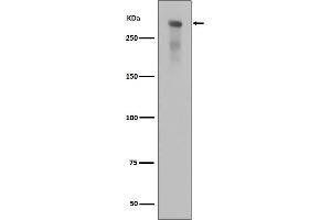 Western Blotting (WB) image for anti-Protein Kinase, DNA-Activated, Catalytic Polypeptide (PRKDC) (pSer2056) antibody (ABIN7606746)