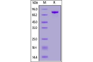 SDS-PAGE (SDS) image for Receptor Tyrosine Kinase-Like Orphan Receptor 1 (ROR1) (AA 30-403) (Active) protein (Fc Tag) (ABIN6992324)