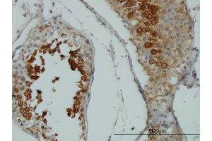 Immunoperoxidase of monoclonal antibody to AKT1 on formalin-fixed paraffin-embedded human testis. (AKT1 Antikörper  (AA 1-480))