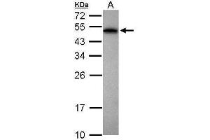 WB Image Sample (30 ug of whole cell lysate) A: Jurkat 12% SDS PAGE antibody diluted at 1:1000 (PABPN1 Antikörper)