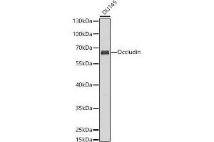 Western blot analysis of extracts of DU145 cells, using Occludin antibody (ABIN6129067, ABIN6144995, ABIN6144997 and ABIN6216324) at 1:1000 dilution. (Occludin Antikörper  (AA 350-450))
