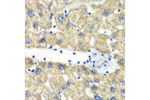Immunohistochemistry (Paraffin-embedded Sections) (IHC (p)) image for anti-4-Aminobutyrate Aminotransferase (ABAT) (AA 29-300) antibody (ABIN6136330)
