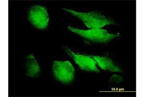 Immunofluorescence of purified MaxPab antibody to FGF1 on HeLa cell. (FGF1 Antikörper  (AA 1-155))