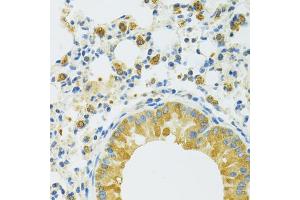 Immunohistochemistry of paraffin-embedded mouse lung using SLC37 antibody (ABIN7270453) at dilution of 1:100 (40x lens). (SLC37A4 Antikörper  (C-Term))