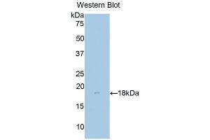 Detection of Recombinant dLK1, Human using Polyclonal Antibody to Delta Like 1 Homolog (dLK1) (DLK1 Antikörper  (AA 177-326))