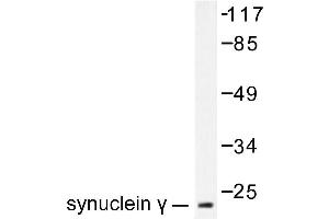 Image no. 1 for anti-Synuclein, gamma (Breast Cancer-Specific Protein 1) (SNCG) antibody (ABIN271916) (SNCG Antikörper)
