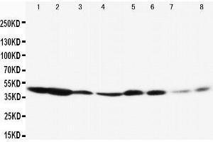 Western Blotting (WB) image for anti-Mitogen-Activated Protein Kinase 3 (MAPK3) (AA 287-301), (Middle Region) antibody (ABIN3044377) (ERK1 Antikörper  (Middle Region))