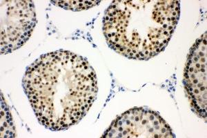 IHC analysis of CCNE1 using anti-CCNE1 antibody (ABIN7601193). (Cyclin E1 Antikörper  (AA 3-386))