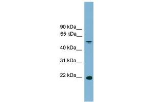 Human Spleen; WB Suggested Anti-HDGFRP3 Antibody Titration: 0. (HDGFRP3 Antikörper  (Middle Region))