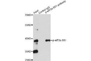 Immunoprecipitation analysis of 200ug extracts of HeLa cells treated by CA using 2. (EIF2S1 Antikörper  (pSer51))