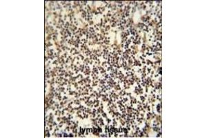 C12orf48 antibody (C-term) (ABIN654041 and ABIN2843950) immunohistochemistry analysis in formalin fixed and paraffin embedded human lymph tissue followed by peroxidase conjugation of the secondary antibody and DAB staining. (PARPBP Antikörper  (C-Term))