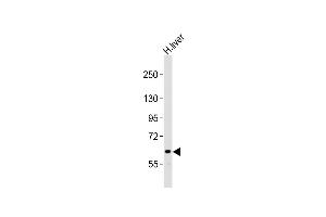 Anti-NOTCH4 Antibody (C-term)at 1:2000 dilution + human liver lysates Lysates/proteins at 20 μg per lane. (NOTCH4 Antikörper  (C-Term))