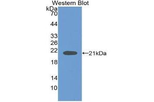 Western blot analysis of the recombinant protein. (Neuroglobin Antikörper  (AA 1-151))
