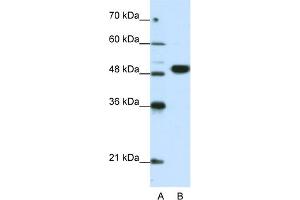 WB Suggested Anti-EIF4A2 Antibody Titration:  0. (EIF4A2 Antikörper  (N-Term))