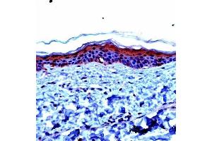 IHC Image: Human skin stained with anti-Involucrin (Involucrin Antikörper  (AA 420-578))