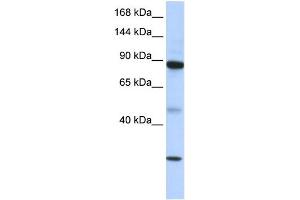 WB Suggested Anti-TDRD9 Antibody Titration: 0.