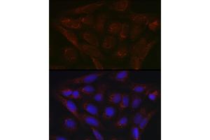 Immunofluorescence (IF) image for anti-Pyruvate Dehydrogenase Kinase, Isozyme 4 (PDK4) (AA 102-411) antibody (ABIN6145396)