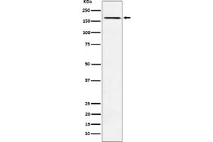 Western blot analysis of AGL expression in K562 cell lysate. (Rekombinanter AGL Antikörper)