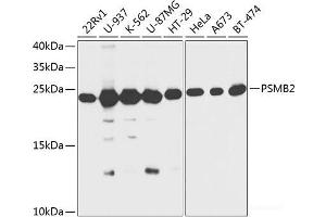 Western Blotting (WB) image for anti-Proteasome (Prosome, Macropain) Subunit, beta Type 2 (PSMB2) antibody (ABIN7257244)