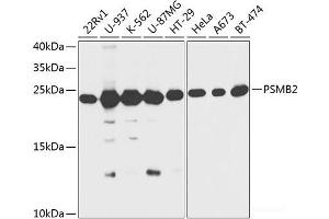 Western blot analysis of extracts of various cell lines using PSMB2 Polyclonal Antibody at dilution of 1:1000. (PSMB2 Antikörper)
