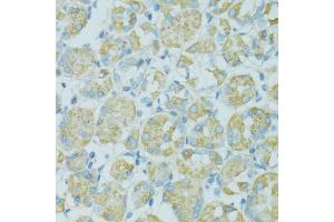 Immunohistochemistry of paraffin-embedded human stomach using TJP2 antibody (ABIN5970222) at dilution of 1/100 (40x lens).