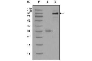 Western Blot showing ETV1 antibody used against truncated Trx-ETV1 recombinant protein (1) and full-length ETV1 (aa1-477)-hIgGFc transfected CHO-K1 cell lysate (2). (ETV1 Antikörper  (AA 1-191))