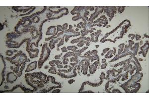 Immunohistochemistry (IHC) image for anti-alpha-Methylacyl-CoA Racemase (AMACR) (AA 367-381), (C-Term) antibody (ABIN7598787) (AMACR Antikörper  (C-Term))