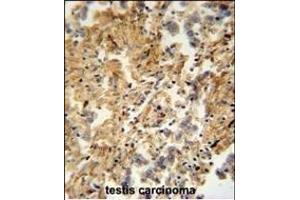 ZMYND10 Antibody (C-term) (ABIN652018 and ABIN2840499) immunohistochemistry analysis in formalin fixed and paraffin embedded human testis carcinoma followed by peroxidase conjugation of the secondary antibody and DAB staining. (ZMYND10 Antikörper  (C-Term))