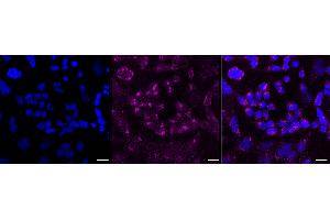 Immunocytochemical staining of HeLa cells with Alkaline phosphatase antibody (ABIN7797575), 1:1,000). (Rekombinanter Alkaline Phosphatase Antikörper)