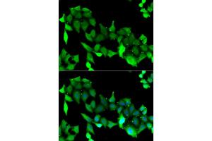 Immunofluorescence analysis of A549 cells using GRK6 antibody (ABIN5973784).