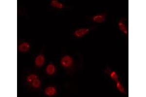 ABIN6266768 staining HuvEc by IF/ICC. (TINF2 Antikörper  (Internal Region))