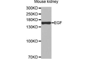 Western Blotting (WB) image for anti-Epidermal Growth Factor (EGF) antibody (ABIN3016522) (EGF Antikörper)