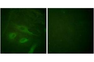 Immunofluorescence analysis of HeLa cells, using IkappaB-epsilon (Ab-22) Antibody. (IkappaB-epsilon Antikörper  (AA 131-180))