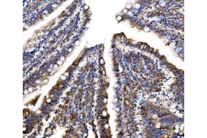 IHC analysis of MLX-interacting protein/MLXIP using anti-MLX-interacting protein/MLXIP antibody (ABIN7602593). (MLXIP Antikörper  (AA 88-348))