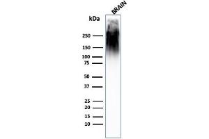 Western Blot Analysis of human brain tissue lysate using Neurofilament MAb (SPM563). (NEFH Antikörper)