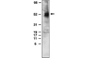 Western Blotting (WB) image for anti-Sphingosine-1-Phosphate Receptor 4 (S1PR4) (C-Term) antibody (ABIN264453)