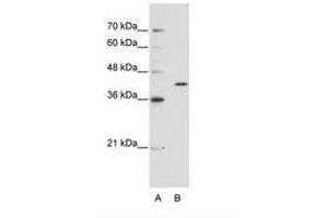 Image no. 1 for anti-Exoribonuclease 1 (ERI1) (AA 231-280) antibody (ABIN202308) (ERI1 Antikörper  (AA 231-280))